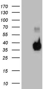 RNASE11 Antibody in Western Blot (WB)