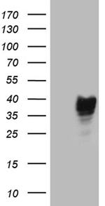 RNASE11 Antibody in Western Blot (WB)