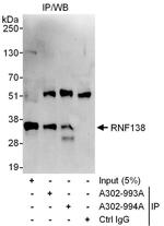 RNF138 Antibody in Immunoprecipitation (IP)