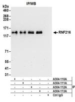 RNF216 Antibody in Immunoprecipitation (IP)