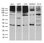 RNF4 Antibody in Western Blot (WB)