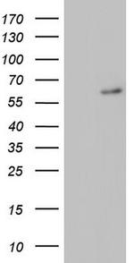 RORA Antibody in Western Blot (WB)