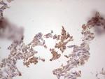 ROS1 Antibody in Immunohistochemistry (Paraffin) (IHC (P))