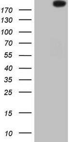 ROS1 Antibody in Western Blot (WB)