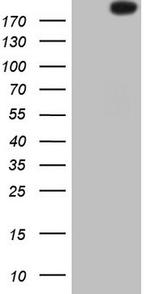 ROS1 Antibody in Western Blot (WB)