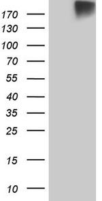 ROS1 Antibody in Western Blot (WB)