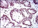 RPA70 Antibody in Immunohistochemistry (Paraffin) (IHC (P))