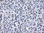 RPA2 Antibody in Immunohistochemistry (Paraffin) (IHC (P))