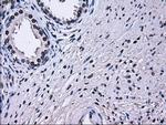 RPA2 Antibody in Immunohistochemistry (Paraffin) (IHC (P))