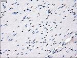 RPA2 Antibody in Immunohistochemistry (Paraffin) (IHC (P))