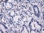 RPA2 Antibody in Immunohistochemistry (Paraffin) (IHC (P))