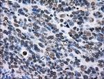 RPA2 Antibody in Immunohistochemistry (Paraffin) (IHC (P))