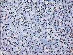 RPA2 Antibody in Immunohistochemistry (Paraffin) (IHC (P))