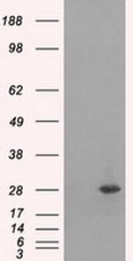 RPA2 Antibody in Western Blot (WB)