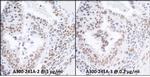 RPA70 Antibody in Immunohistochemistry (IHC)