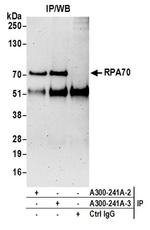 RPA70 Antibody in Western Blot (WB)