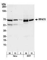 RPA70 Antibody in Western Blot (WB)