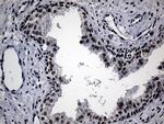 RPAIN Antibody in Immunohistochemistry (Paraffin) (IHC (P))