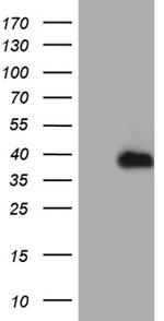 RPAIN Antibody in Western Blot (WB)