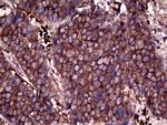 RPL10A Antibody in Immunohistochemistry (Paraffin) (IHC (P))