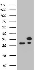 RPL10A Antibody in Western Blot (WB)