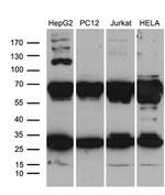 RPL10A Antibody in Western Blot (WB)