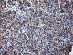 RPN1 Antibody in Immunohistochemistry (Paraffin) (IHC (P))