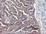 RPN1 Antibody in Immunohistochemistry (Paraffin) (IHC (P))