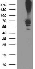 RPN1 Antibody in Western Blot (WB)