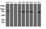 RPN1 Antibody in Western Blot (WB)