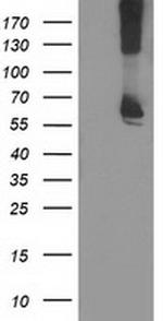 RPN1 Antibody in Western Blot (WB)