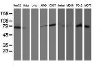 RPN1 Antibody in Western Blot (WB)