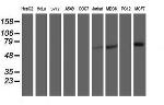 RPN1 Antibody in Western Blot (WB)