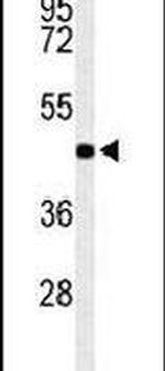 RPRD1B Antibody in Western Blot (WB)