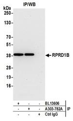 RPRD1B Antibody in Western Blot (WB)