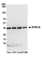 RPRD1B Antibody in Western Blot (WB)