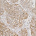 Ribosomal Protein S3A/RPS3A Antibody in Immunohistochemistry (IHC)