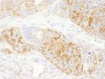 RPS6 Antibody in Immunohistochemistry (IHC)