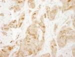 RPS6 Antibody in Immunohistochemistry (IHC)