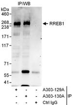 RREB1 Antibody in Immunoprecipitation (IP)