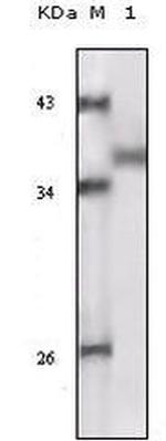 RSK1 Antibody in Western Blot (WB)