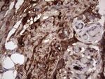 RSPO3 Antibody in Immunohistochemistry (Paraffin) (IHC (P))