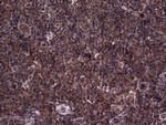 RSPO3 Antibody in Immunohistochemistry (Paraffin) (IHC (P))