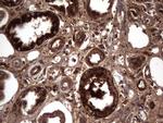 RSPO3 Antibody in Immunohistochemistry (Paraffin) (IHC (P))