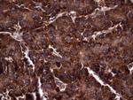 RSPO3 Antibody in Immunohistochemistry (Paraffin) (IHC (P))