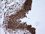 RTKN Antibody in Immunohistochemistry (Paraffin) (IHC (P))