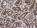 RTKN Antibody in Immunohistochemistry (Paraffin) (IHC (P))