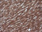 RTKN Antibody in Immunohistochemistry (Paraffin) (IHC (P))