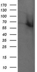 RTKN Antibody in Western Blot (WB)
