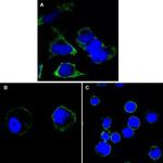 RTN3 Antibody in Immunocytochemistry (ICC/IF)